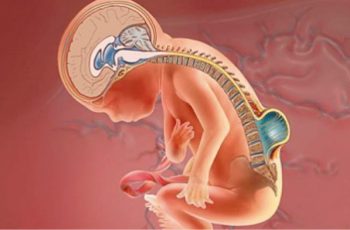 espina-bifida-tipos-cirugia pediatra en cancun